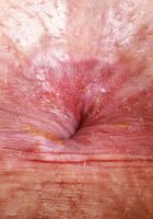 ATK Petites: Amber Maddie (Amber Maddie has her bikini on)