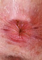 Apricot Pitts from ATK Natural & Hairy