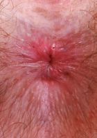 ATK Petites: Big Eyes (Big Eyes whips out the big guns)