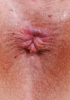 ATK Galleria: Dolly Paige (Dolly Paige Loves to Show Pink Pussy)