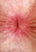 ATK Petites: Fiona Sprouts (Fiona Peaches is in a lovely mood)