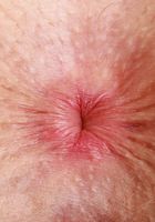 ATK Natural & Hairy: Fiona Peaches (Sexy sweetheart Fiona Peaches takes it off)