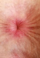 ATK Natural & Hairy: Fiona Peaches (Let Fiona Peaches put you in the mood)