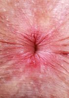 ATK Natural & Hairy: Fiona Peaches (Come taste Fiona Peaches' sweet juices)