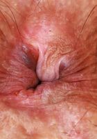 ATK Exotics: Hazel Heart (Hazel Heart is coming up all cherry's and strawberries)