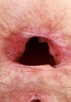 ATK Petites: Jackie Hoff (Jackie Hoff is sporting a wild bush)