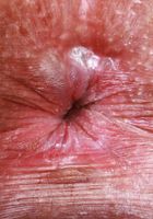 ATK Petites: Katerina Karson (Katerina Karson Nude Foot Fetish Pussy and Ass Spreading)