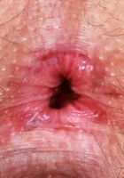 ATK Natural & Hairy: Lenna (Curvy hairy Lenna shows it all.)