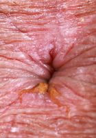 Leila Mills from ATK Exotics