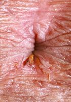 ATK Exotics: Leila Mills (Leila Mills lets you look up her dress)