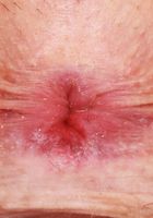 ATK Galleria: Nova Vixen (Nova Vixen Outdoor Nudes)