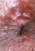 Rhae Woods from ATK Exotics