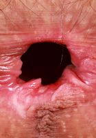 ATK Natural & Hairy: Sia Wood (Sia Wood is wearing the shirt that says it all)