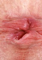 ATK Galleria: Sydney Paige (Sydney Paige Strips off Her Skirt)